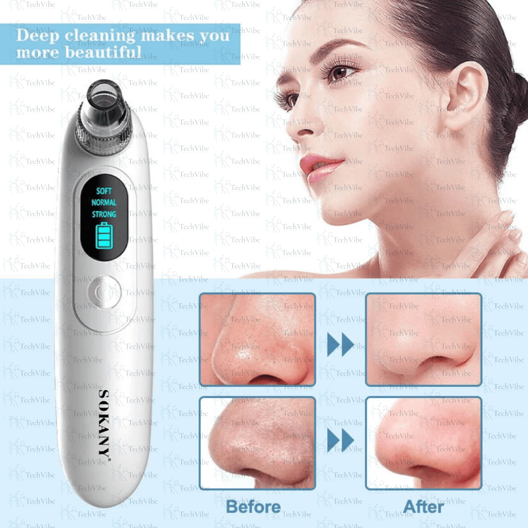 Sokany Multi - Skin Usb Blackhead Remover With Real - Time Power Monitoring - TechVibe