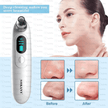 Sokany Multi - Skin Usb Blackhead Remover With Real - Time Power Monitoring - TechVibe