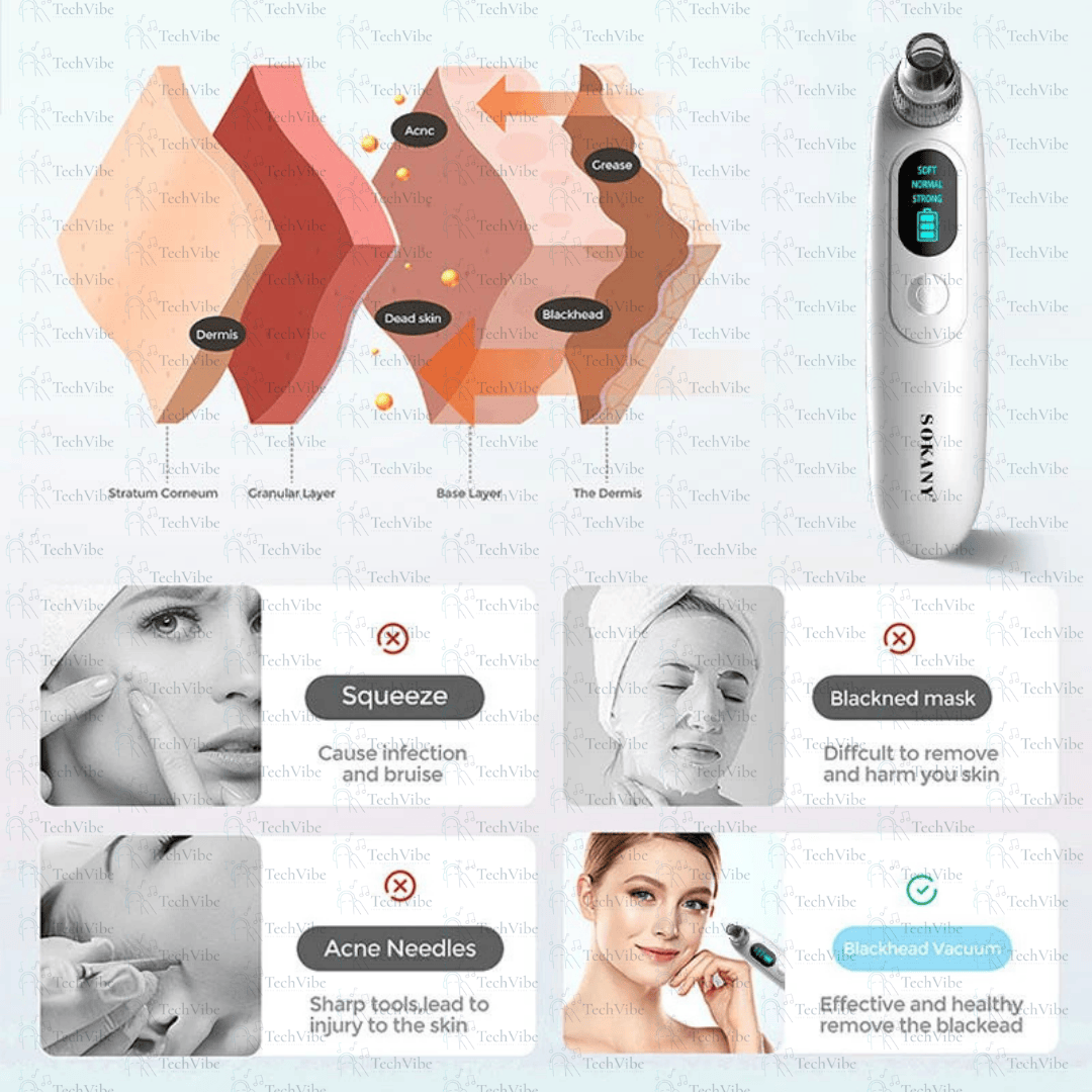 Sokany Multi - Skin Usb Blackhead Remover With Real - Time Power Monitoring - TechVibe
